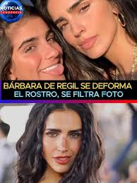 Bárbara de Regil se deforma el rostro, se filtra foto #barbaraderegil  #noticiastendencia