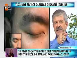 Yuzumuzdeki Kil Kurtlari Youtube Saglik Cilt Bakimi Youtube