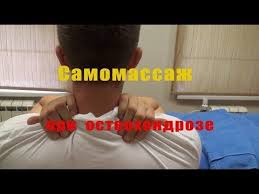 как снять боль при шейном остеохондрозе в домашних условиях Samomassazh Pri Shejnom Osteohondroze I Triggernym Tochkam Massazh Bystrye Trenirovki Zdorove