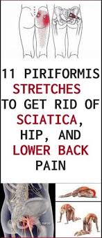 Pin On Extreme Sciatic Nerve Pain