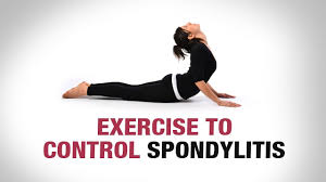 exercise to control spondylitis yoga