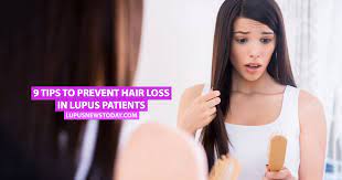However, you can prevent the severity and promote healing by using the same hair mask i do for hair loss treatment. 9 Tips To Prevent Hair Loss In Lupus Patients Lupus News Today