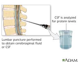 Unsure if your results are normal and what the values mean? Csf Total Protein Information Mount Sinai New York