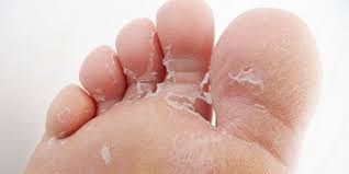 Frequently using a moisturizer, especially right after bathing, when your skin is damp; A Photo Diary Of Footner Socks The Genius Gross So Gross Way To Get Rid Of Dry Skin On Your Feet