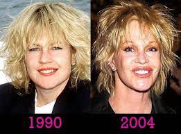 02.09.2019 · melanie griffith plastic surgery. Melanie Griffith Before And After Plastic Surgery Showed Her Rollercoaster Ride In Life Lifestyle Blog