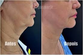 LASER AESTHETIC SURGERY COURSE