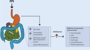 Maybe you would like to learn more about one of these? Protonenpumpenhemmer Fur Den Intensivpatienten Springerlink