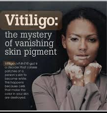 Dr. Mira Walker (@vitiligo_beautified) • Instagram photos and videos