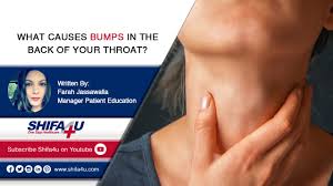 It will start small and grow significantly larger if you dont have it surgically removed. What Causes Bumps In The Back Of Your Throat