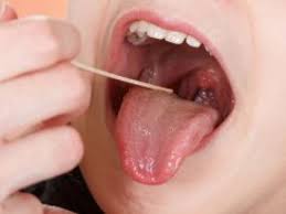 Berikut adalah beberapa petua yang boleh mommies amalkan jika si kecil mendapat sakit tekak. Jangkitan Pada Tonsil Sering Menyerang Si Manja June 2021 Kelabmama Malaysia