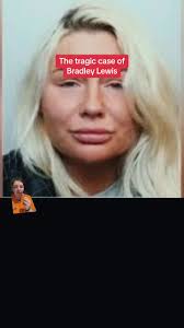 Abigail Wheat Accident