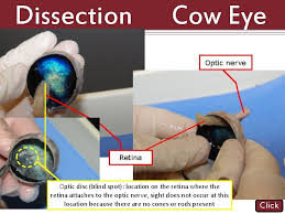 Maybe you would like to learn more about one of these? Dissection 101 Reasons To Use The Dissection Video