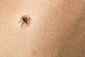 There are many common names for various ticks (for example, dog tick, deer tick, and african tick. These Horrifying Pictures Show The Exact Tick Bite Symptoms To Look For