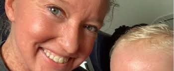 Woman, Son With Rare Skin Condition Kicked Off American Airlines Flight