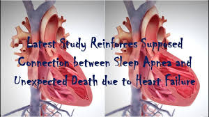 Risks Of Untreated Sleep Apnea The Relationship Between Sleep Apnea An Sleep Apnea Apnea How Are You Feeling