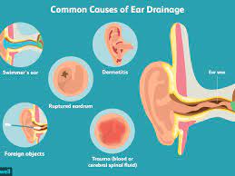 Maybe you would like to learn more about one of these? Causes And Treatment For Ear Drainage