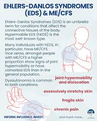 Image result for Hypermobility Signs