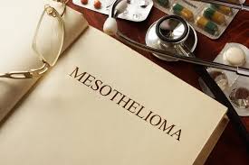 Mesothelioma is a very rare cancer and mesothelioma symptoms can be similar to many other diseases and ailments. Mesothelioma Symptoms Recognizing The Early Signs Of Mesothelioma