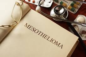 There is a strong association between chronic hepatitis b. Mesothelioma Symptoms Recognizing The Early Signs Of Mesothelioma
