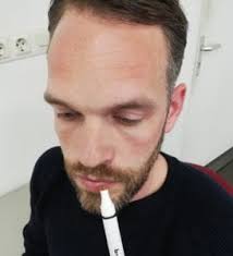 How to use the Sniffin' Sticks