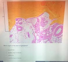 Elastin fibers provide some elasticity to the skin, enabling movement. Co Which Region Of The Skin Is Highlighted Chegg Com