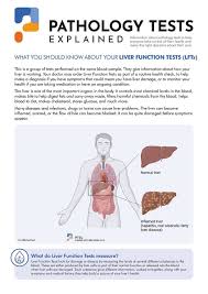 Image result for Liver Function Test