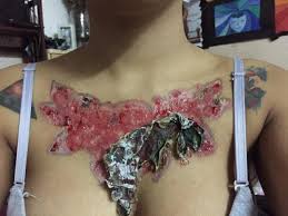 The body will continue to eliminate the ink's particles for months and even years after your final treatment. Student Reveals Painful Scars Left When Tattoo Removal Went Horribly Wrong