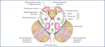 Of the brain stem, so that you can determine if a gross or stained cross section is medulla, pons or midbrain. Brainstem Textbook Of Clinical Neuroanatomy 2 Ed