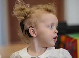 Cochlear implant allows three-year-old girl to hear for the first time