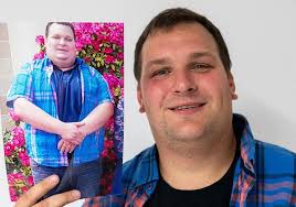 Adipositas Chirurgie