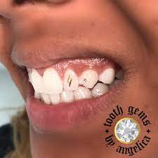 24k Gold Lightning Bolt Tooth Gem Tooth Gem Teeth Jewelry Diamond Teeth