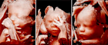 Hallo mädels, ich bin ab heute 17. 3d 4d Ultraschall Und Organscreening Bei Frauenheilkunde Herten