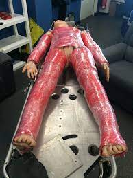 An escharotomy is an incision made completely through the depth of the burn eschar that usually occurs within the first day of the injury. Build Your Own Escharotomy Man Greater Sydney Area Hems