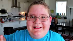 A Day in the Life of Ruby (Living with a Rare Syndrome)