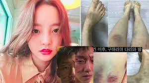 K Pop Idol S Sex Tape Gets 200 000 Searches In Korea After Ex Boyfriend Abuse Scandal