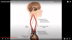 Other common triggers can include rolling over in bed, looking upwards and bending over. Can Cervical Spine Instability Cause Heart Palpitations And Blood Pressure Problems Caring Medical Florida