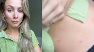 Influencerin Carmushka: "Stellt mal vor, ich habe Flöhe!"