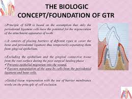 Guided Tissue Regeneration