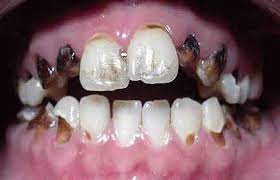 Smartphone entzug so klappt die trennung in digitalen zeiten. Crystal Meth Und Methamphetamin Heimtest Schnelltests De