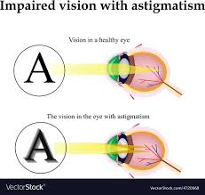 Astigmatism As The Eye Can See With Astigmatism