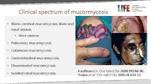 The infection causes pain, fever, and sometimes cough and can destroy structures in the face. Mucormycosis Prof David W Denning Professor Of Infectious