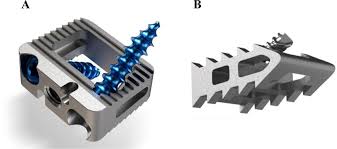 In partnership with our affiliated providers and network of medical groups, we offer a comprehensive range of services including primary, cancer, heart and vascular and. Surgical Implants Used In This Study A Zero Profile Anterior Download Scientific Diagram