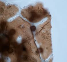 Image result for Melanospermum