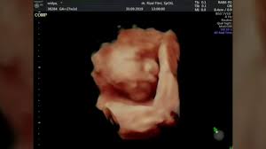 Ketahui apa yang sedang berlaku dengan baby anda. Usg 5d Janin 27 Minggu Lagi Makan Gemesin Banget Youtube