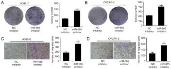 Ovarian cancer affects a woman's ovaries and surrounding structures. Microrna 665 Suppresses The Growth And Migration Of Ovarian Cancer Cells By Targeting Hoxa10