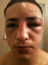 Ufc vegas 26 lost several fights ahead of the event, including exchanges diego sanchez and ufc veteran donald cerrone. Diego Sanchez Reacts To His Defeat Against Bj Penn