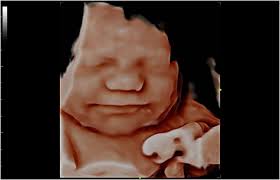 Do you know a momma and want to give her the gift of seeing her baby ? If  so we offer gift certificates. You can pick up at the studio Or we