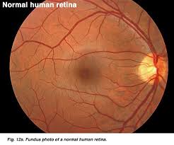 Pin On Ophthalmology Optometry