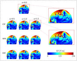 Check spelling or type a new query. Influence Of Segmentation Accuracy In Structural Mr Head Scans On Electric Field Computation For Tms And Tes Iopscience