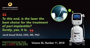 We are offering 30% discounts on all mobiles phone & laptops. Is Laser The Best Choice For The Treatment Of Peri Implantitis Light Instruments Ltd